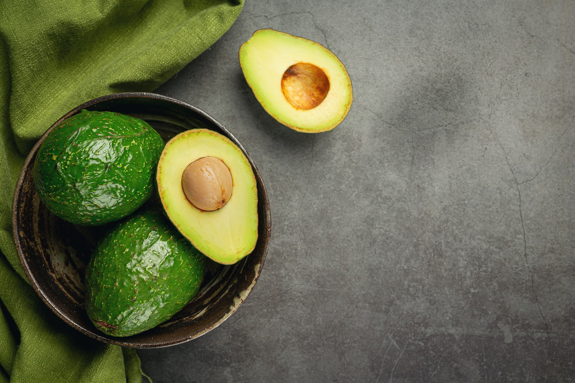 avocadoes image
